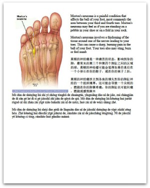 MortonNeuroma